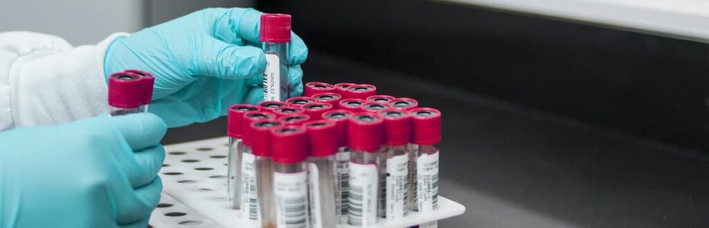 Vials of blood being tested in a laboratory setting