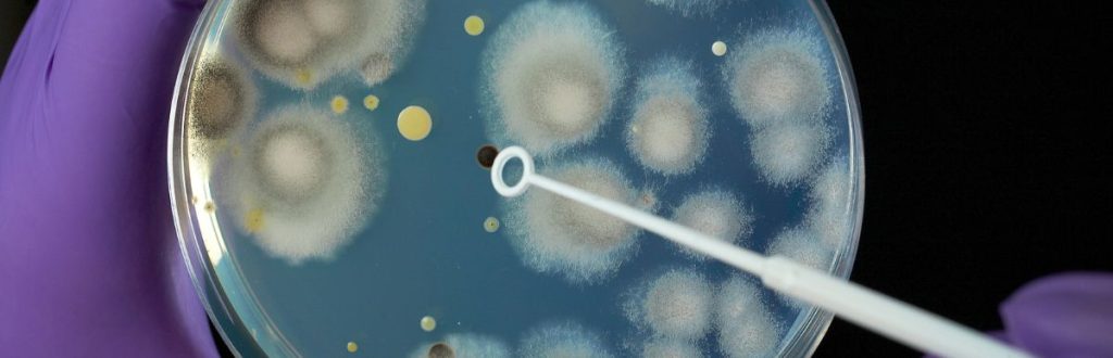 White and gray mold growing in petri dish with blue medium.